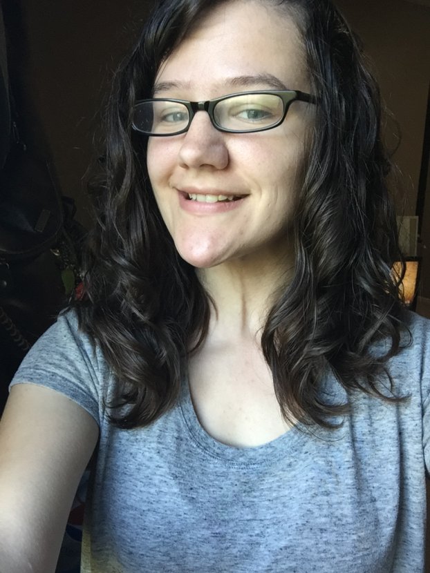 Scalp problems from the curly girl method